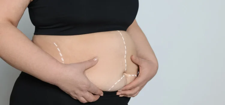 Adölesanlarda Obezite Cerrahisi: Riskler ve Etik Boyutlar